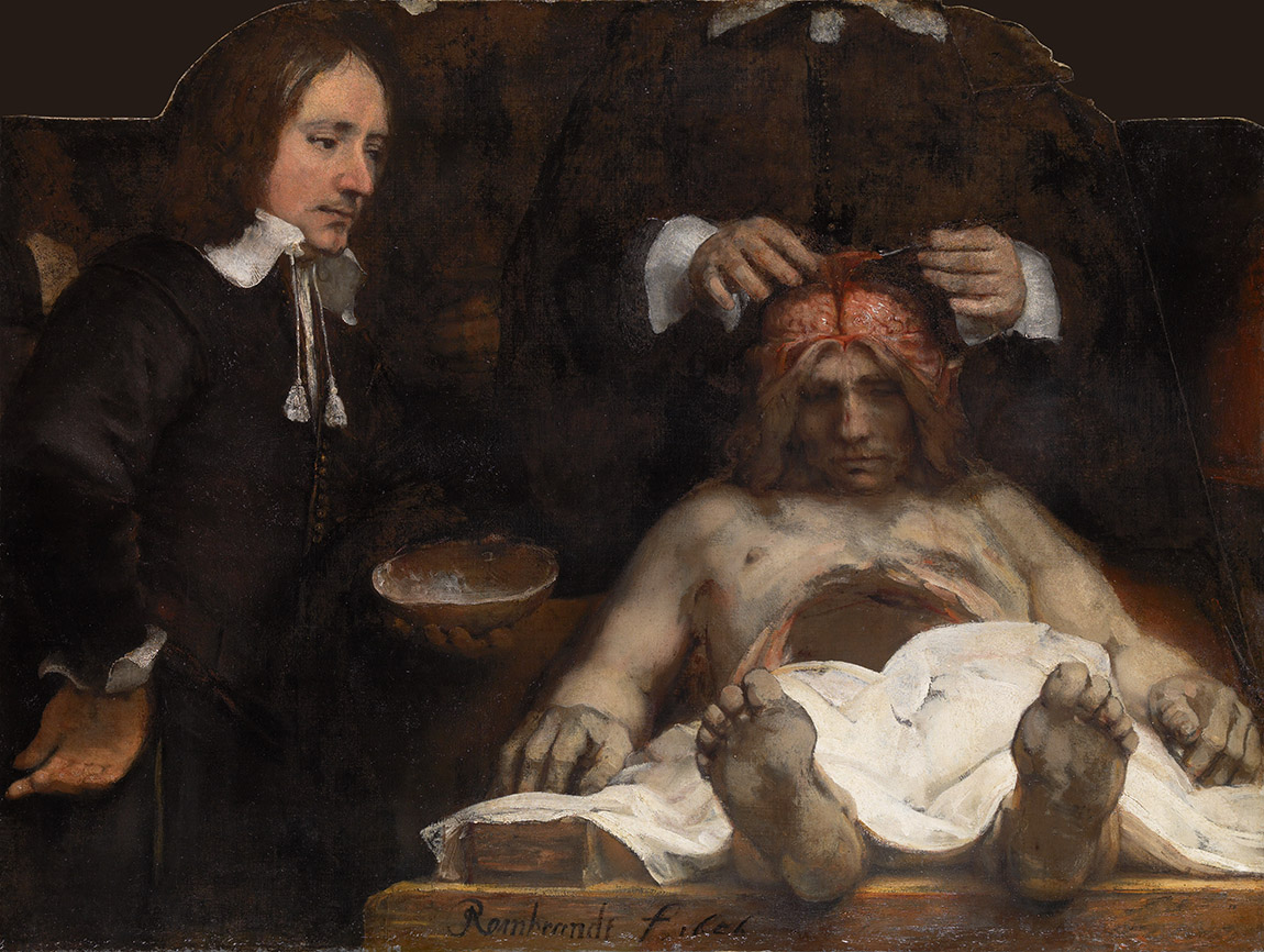Rembrandt, De anatomische les van Jan Deijman, 1656, collection at Amsterdam Museum